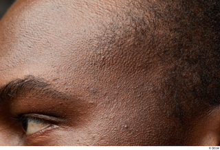  HD Face Skin Kavan face forehead skin pores skin texture 0001.jpg